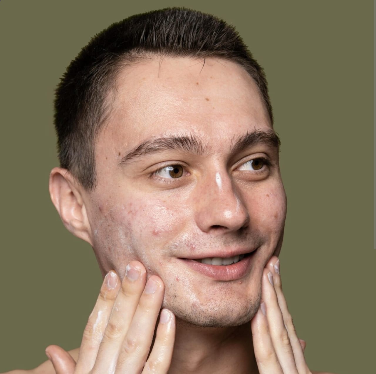 Cara Mengatasi Bercak Putih di Wajah