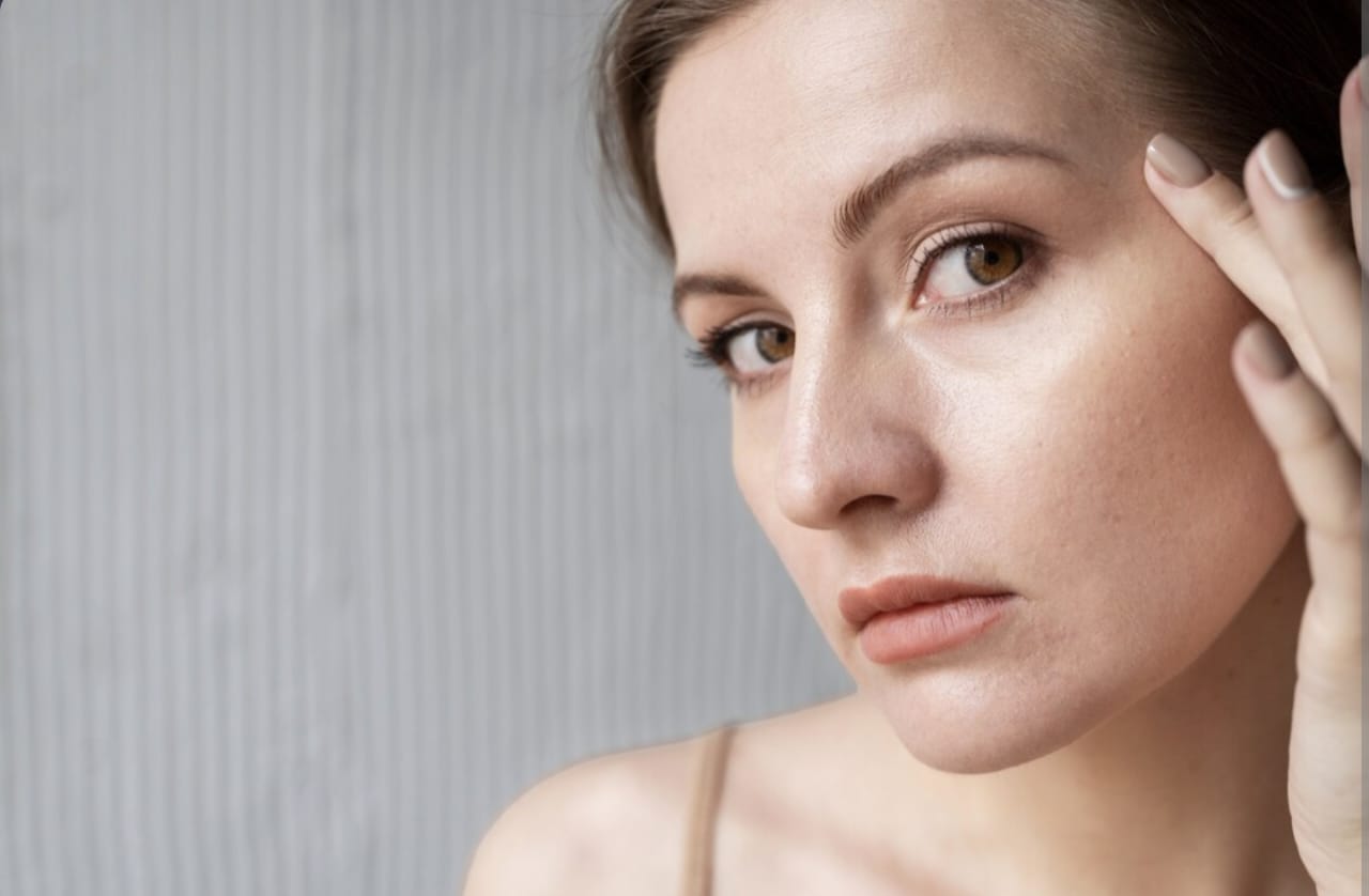 Cara Mengatasi Bercak Putih di Wajah