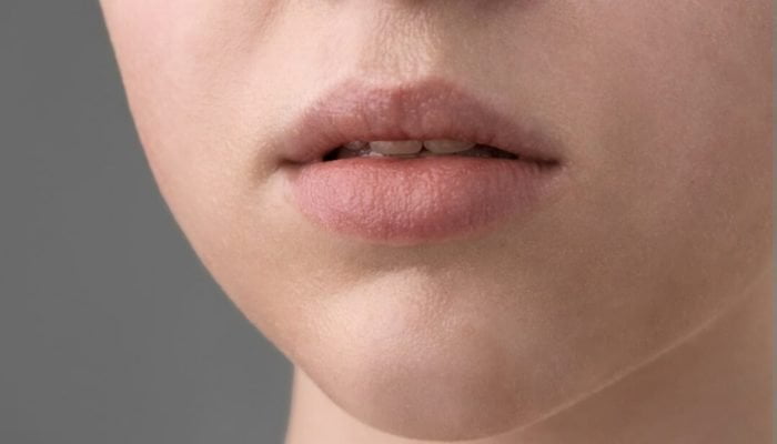 Arti Jerawat di Bawah Bibir, Bisa Jadi Tanda Penyakit Serius!