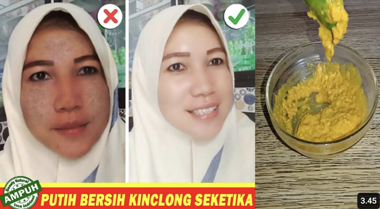 Cara Menghilangkan Flek Hitam di Usia 40 Tahun Secara Alami